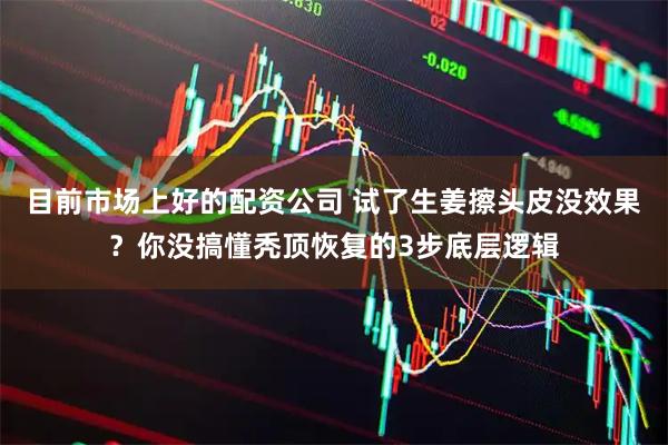 目前市场上好的配资公司 试了生姜擦头皮没效果？你没搞懂秃顶恢复的3步底层逻辑